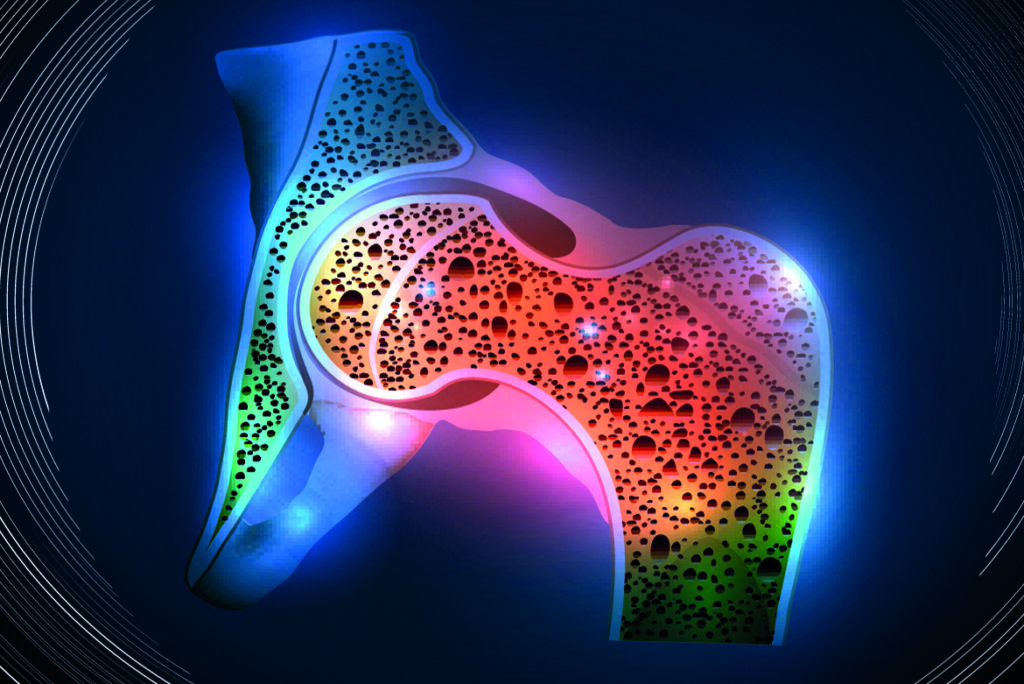 Osteoporosis: control y prevención - Apoteca Natura